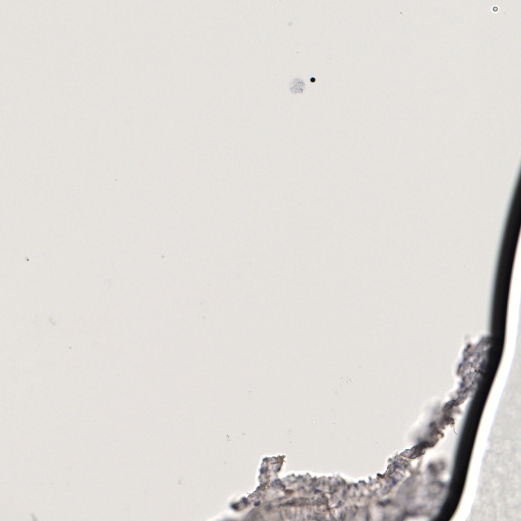 slice_59_7_x52864_y6272.png