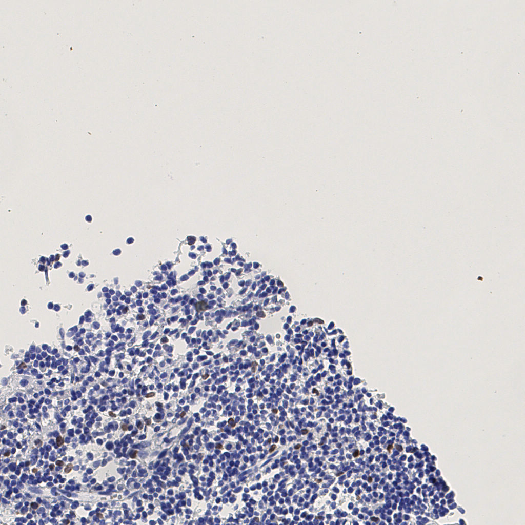 slice_5_10_x4480_y8960.png
