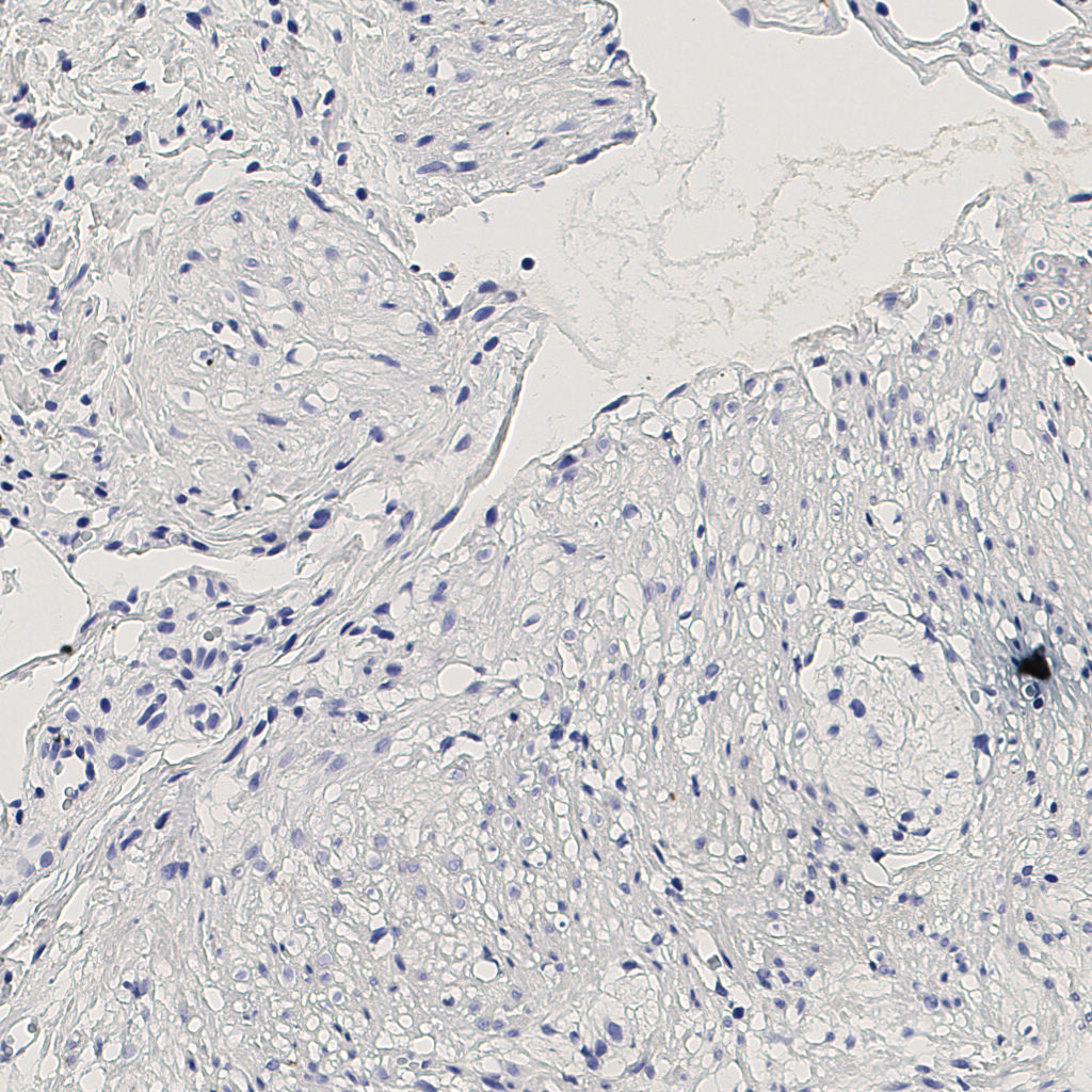 slice_5_20_x4480_y17920.png