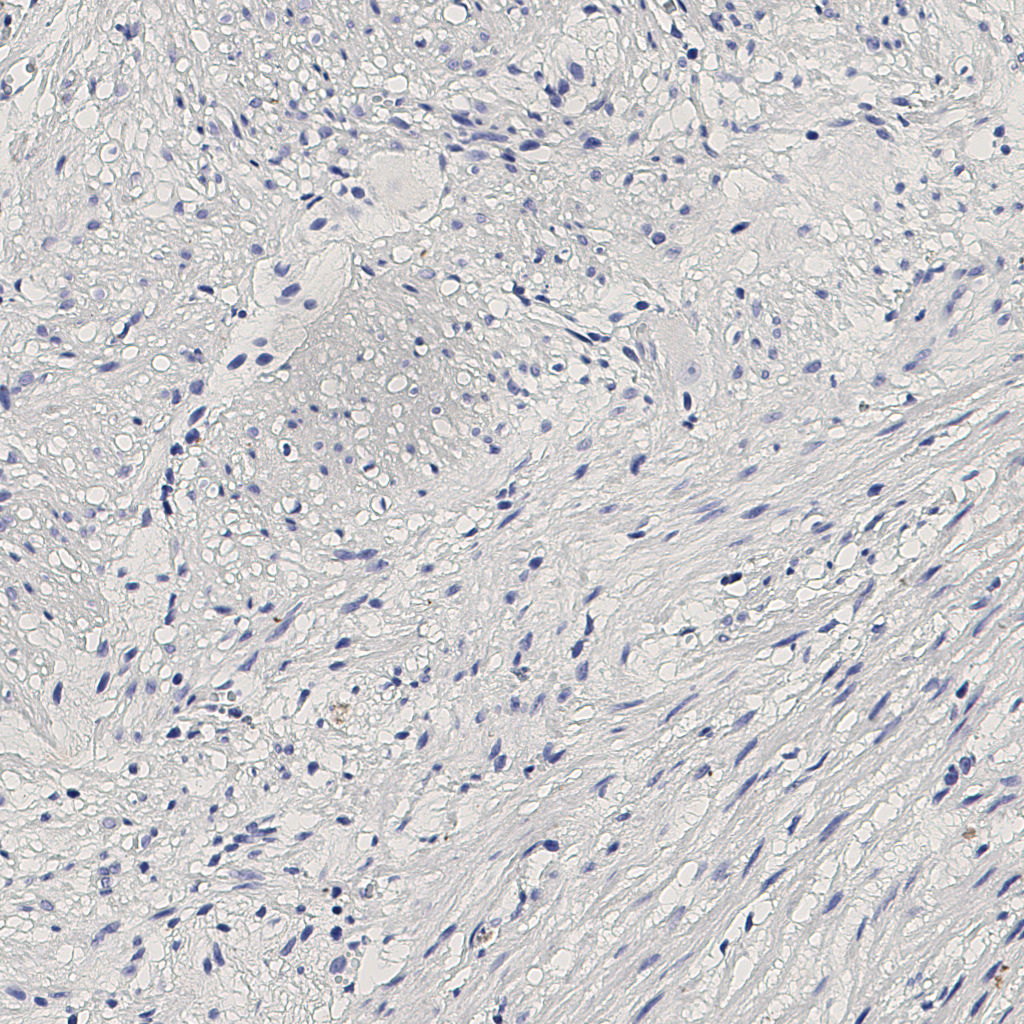 slice_5_21_x4480_y18816.png