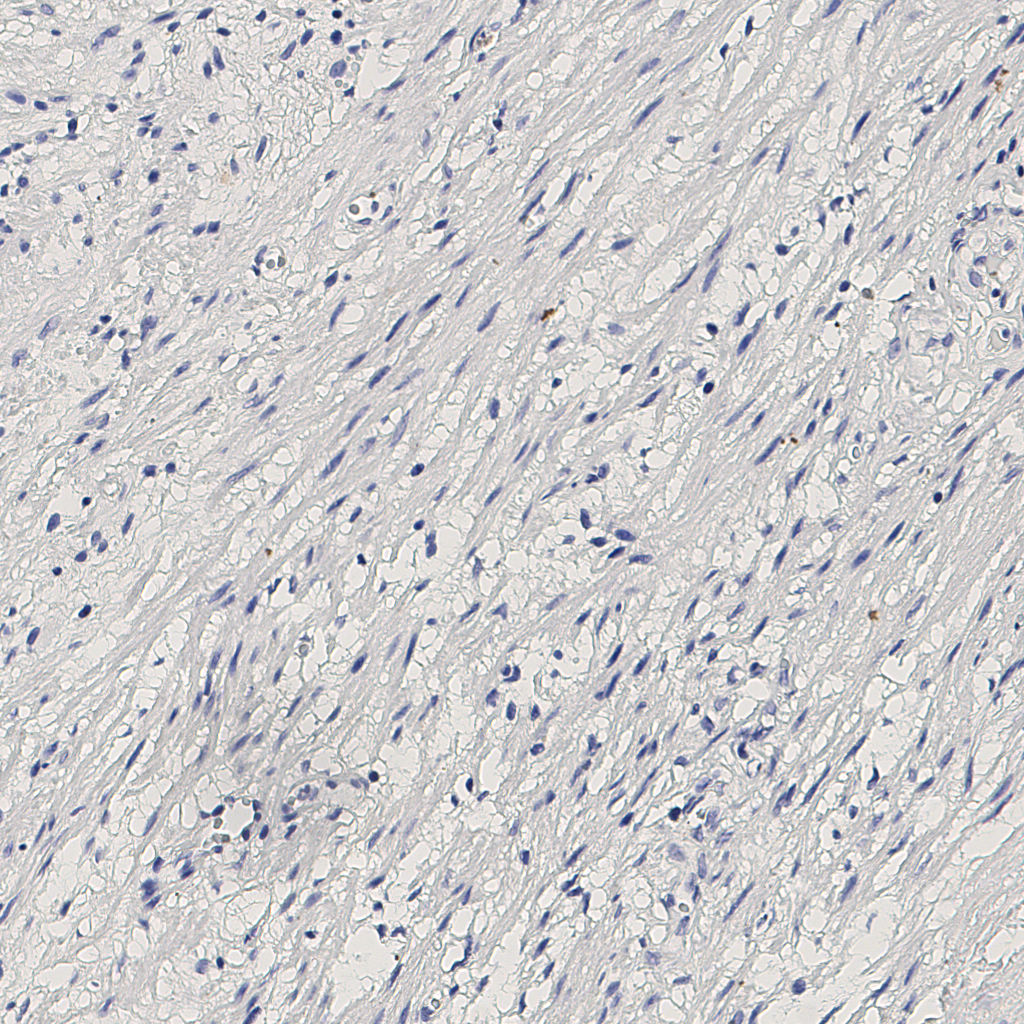 slice_5_22_x4480_y19712.png
