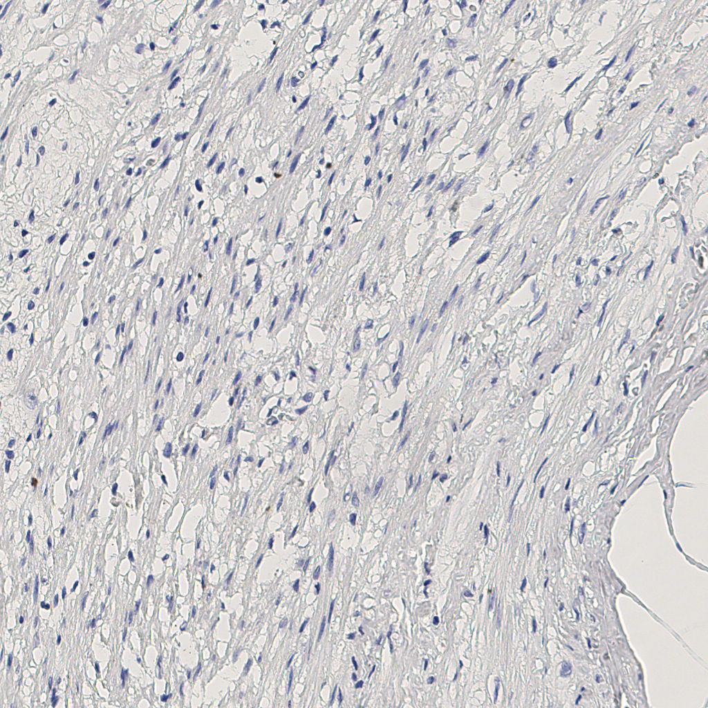 slice_5_23_x4480_y20608.png