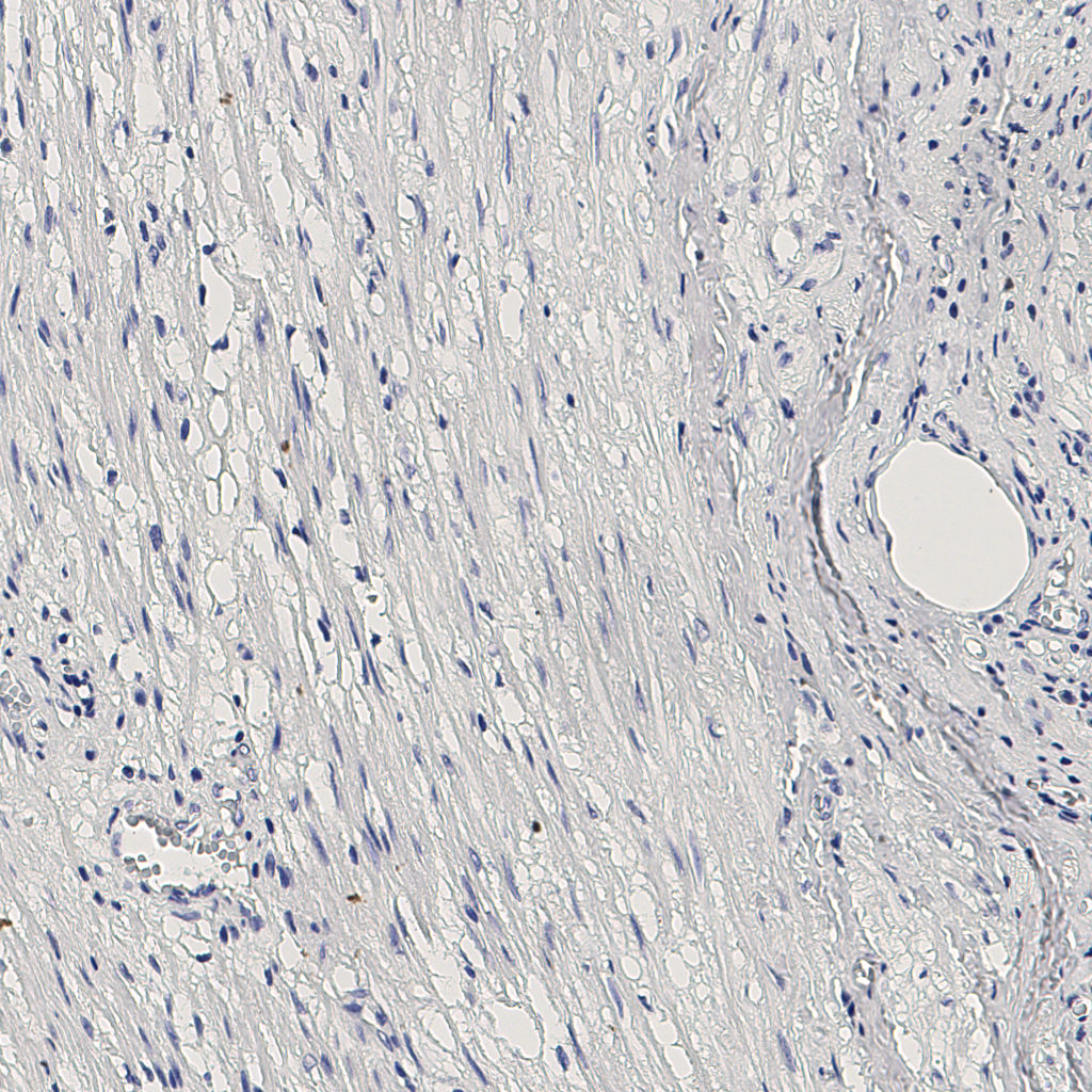 slice_5_25_x4480_y22400.png