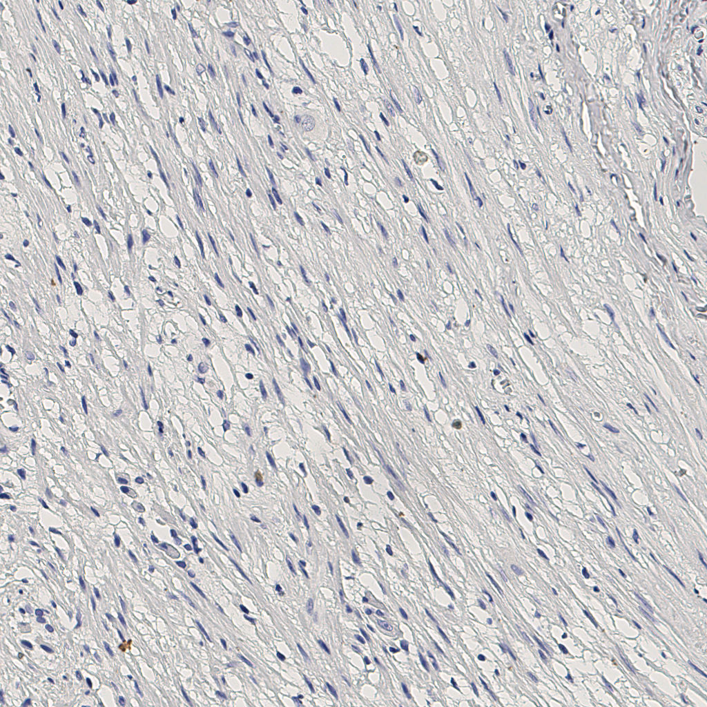 slice_5_26_x4480_y23296.png
