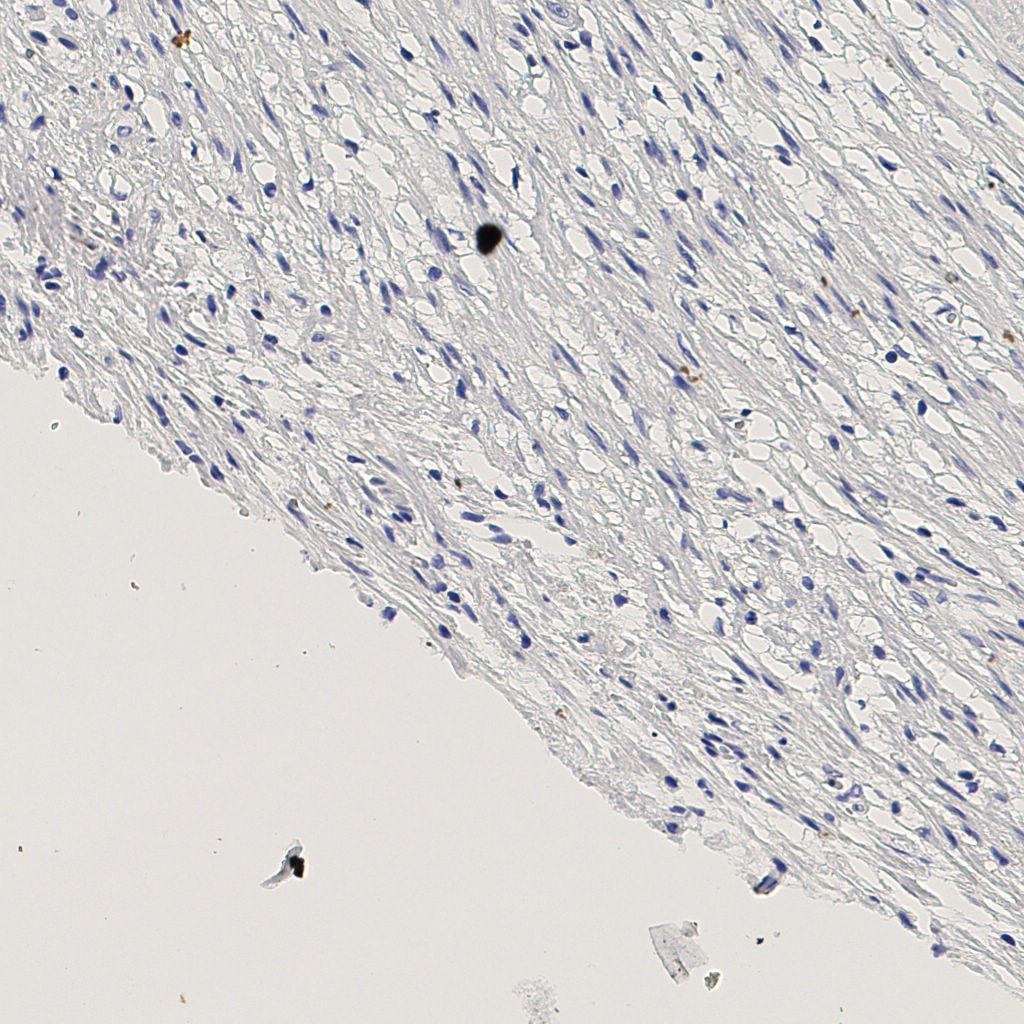 slice_5_27_x4480_y24192.png