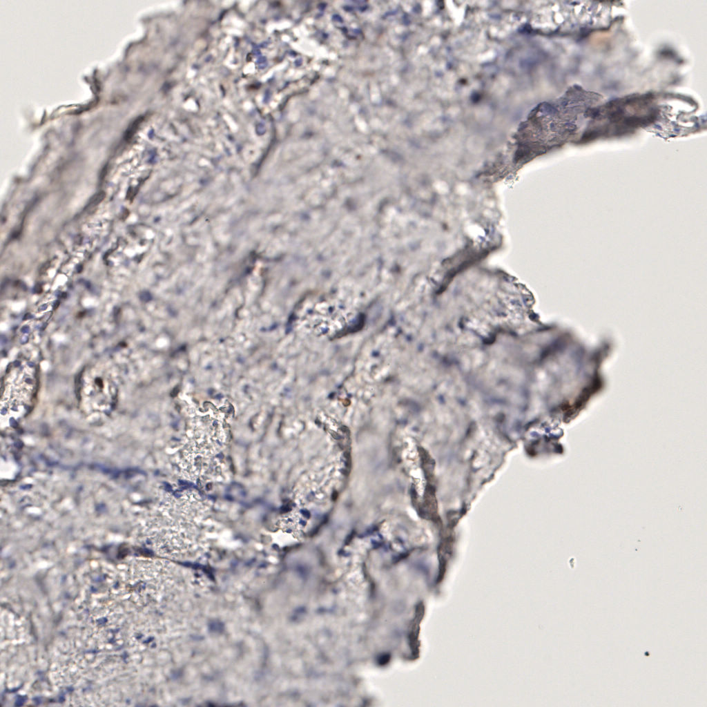slice_61_16_x54656_y14336.png