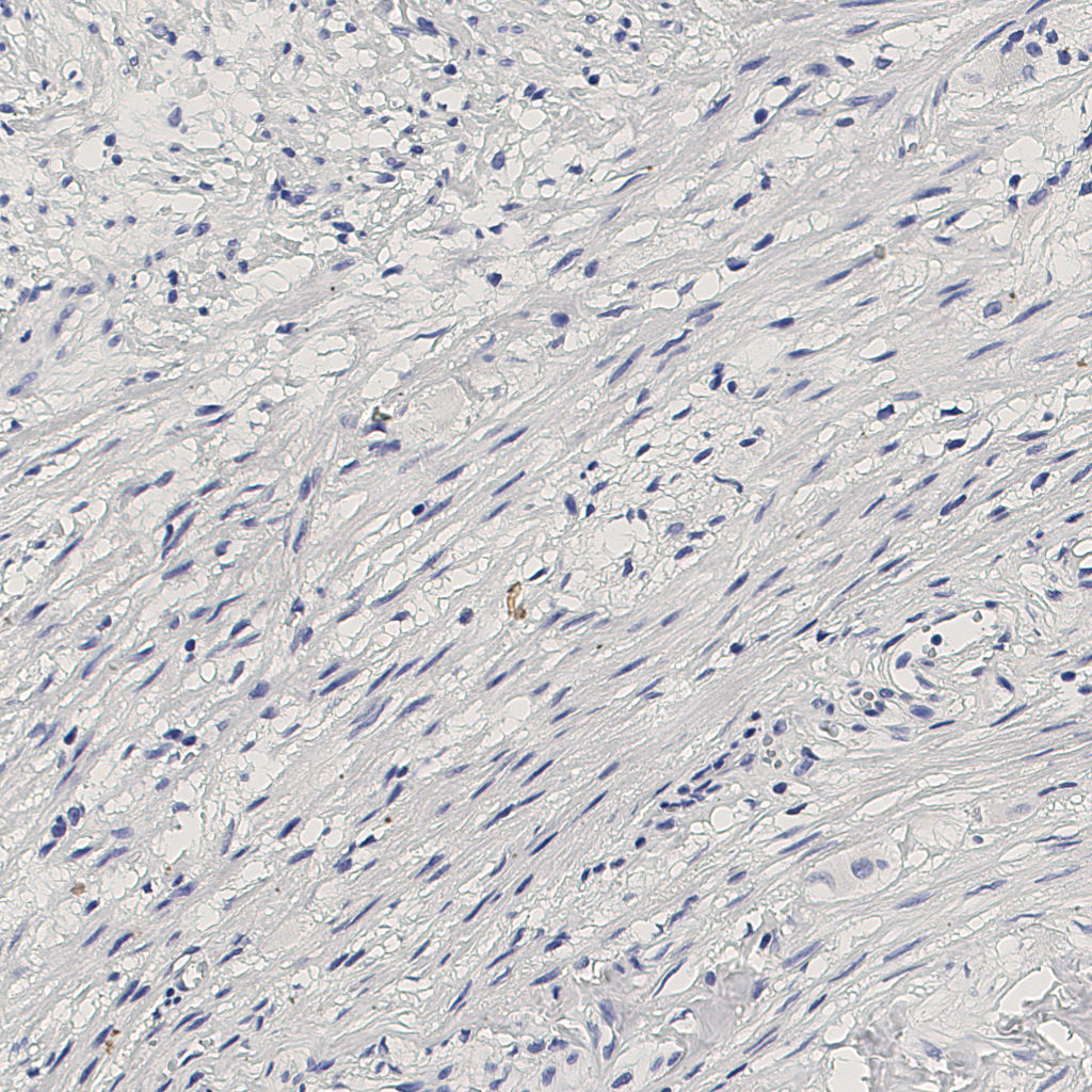 slice_6_21_x5376_y18816.png