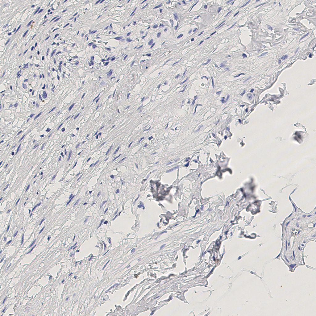 slice_6_22_x5376_y19712.png