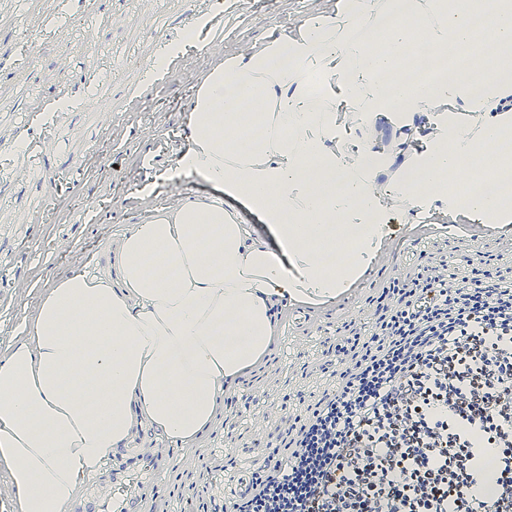 slice_6_23_x5376_y20608.png