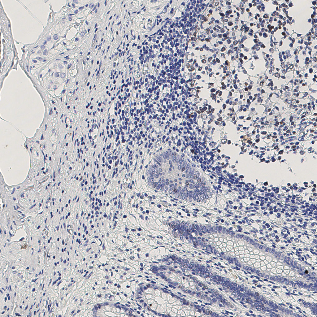 slice_6_24_x5376_y21504.png