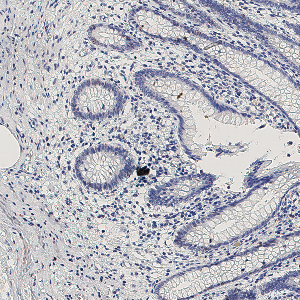 slice_6_25_x5376_y22400.png