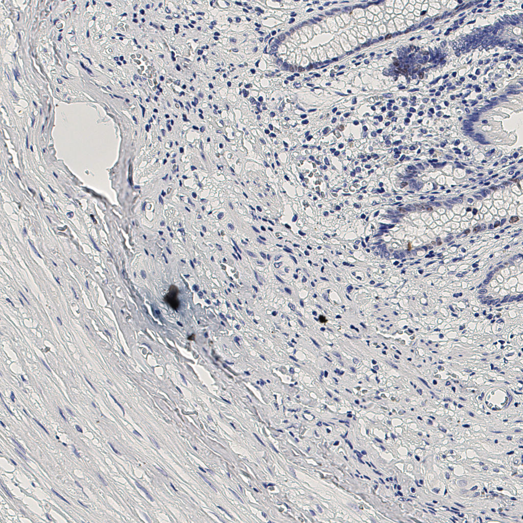 slice_6_26_x5376_y23296.png