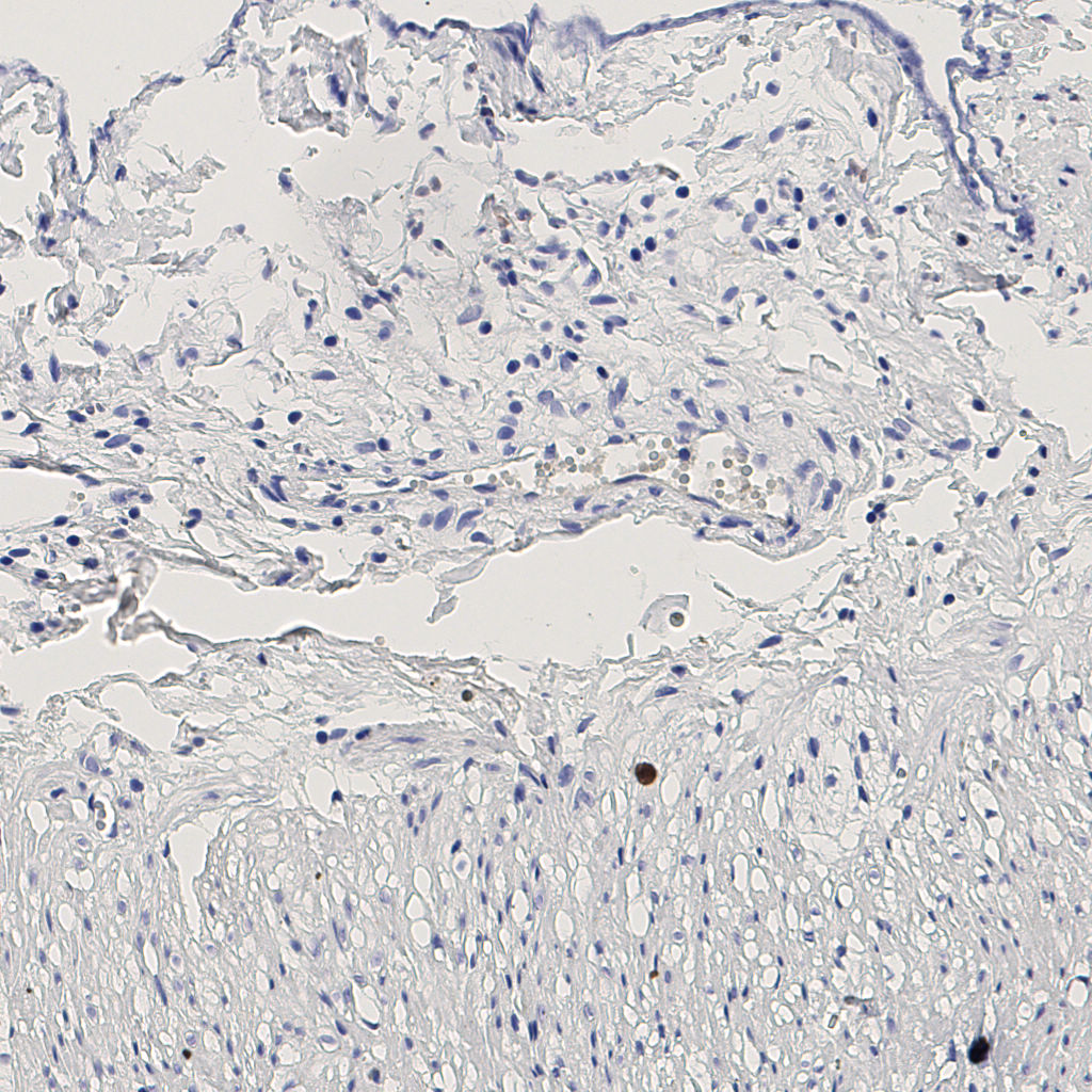 slice_7_19_x6272_y17024.png