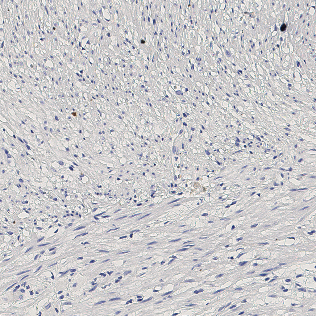 slice_7_20_x6272_y17920.png