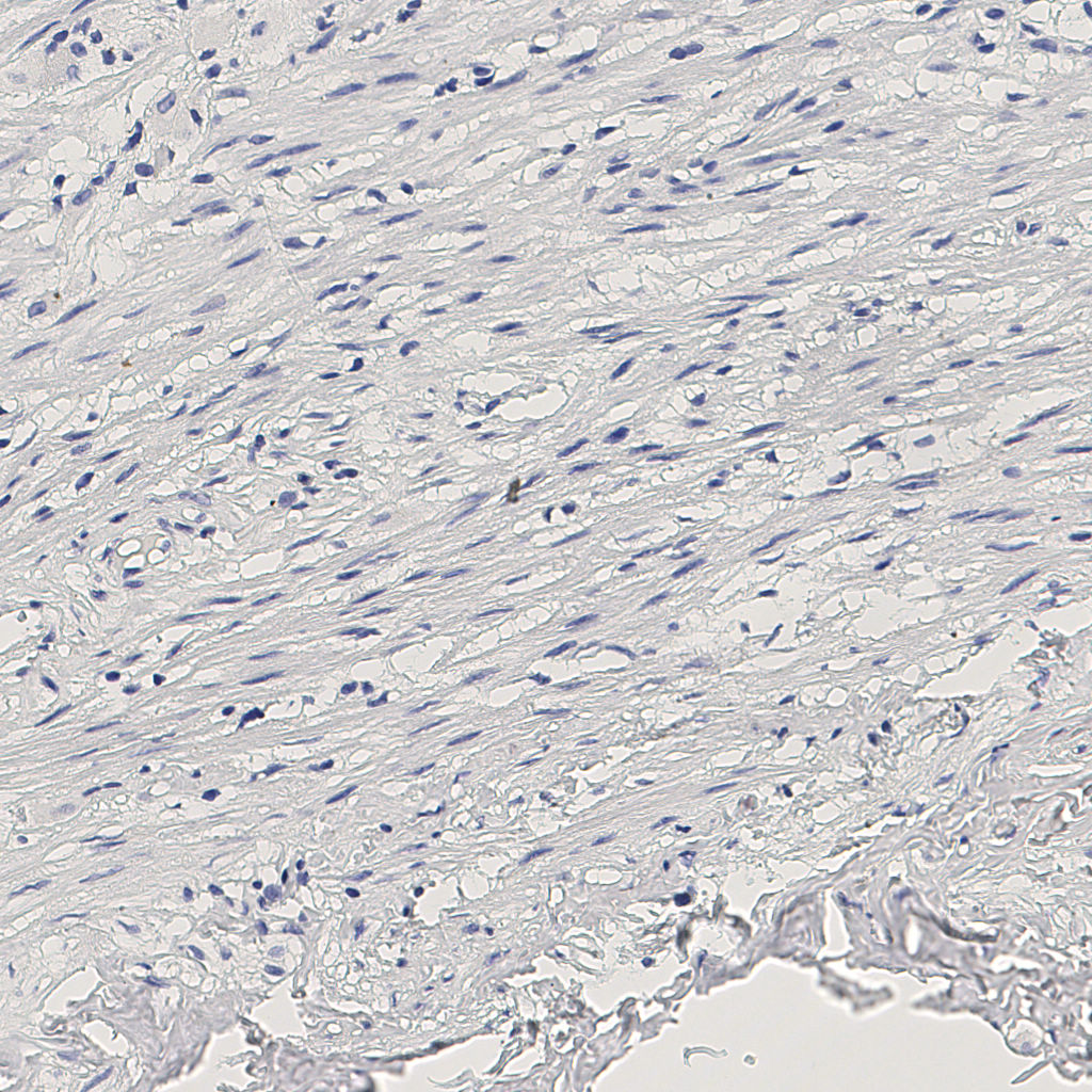 slice_7_21_x6272_y18816.png