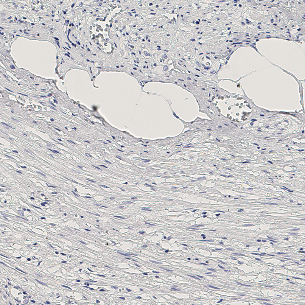 slice_7_27_x6272_y24192.png