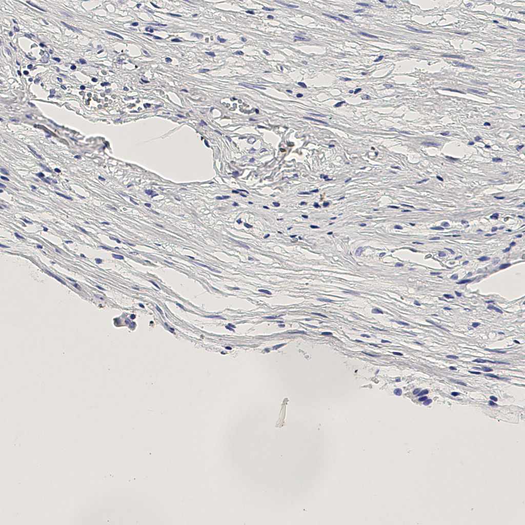 slice_7_28_x6272_y25088.png