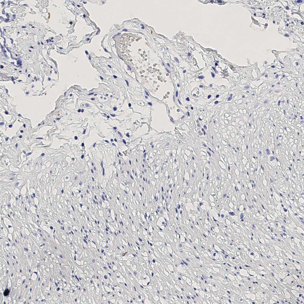 slice_8_19_x7168_y17024.png