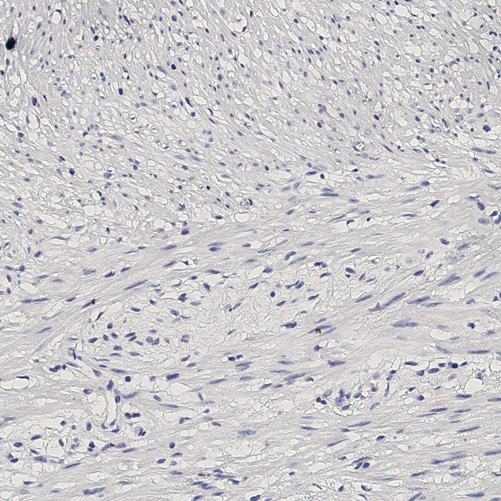 slice_8_20_x7168_y17920.png