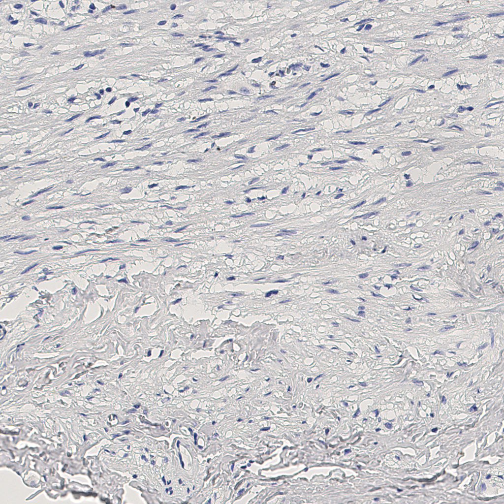 slice_8_21_x7168_y18816.png