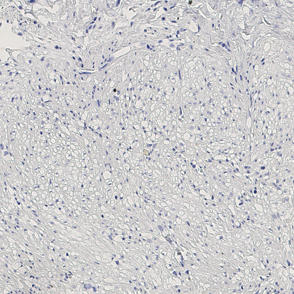slice_9_19_x8064_y17024.png