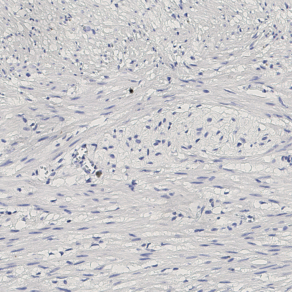 slice_9_20_x8064_y17920.png