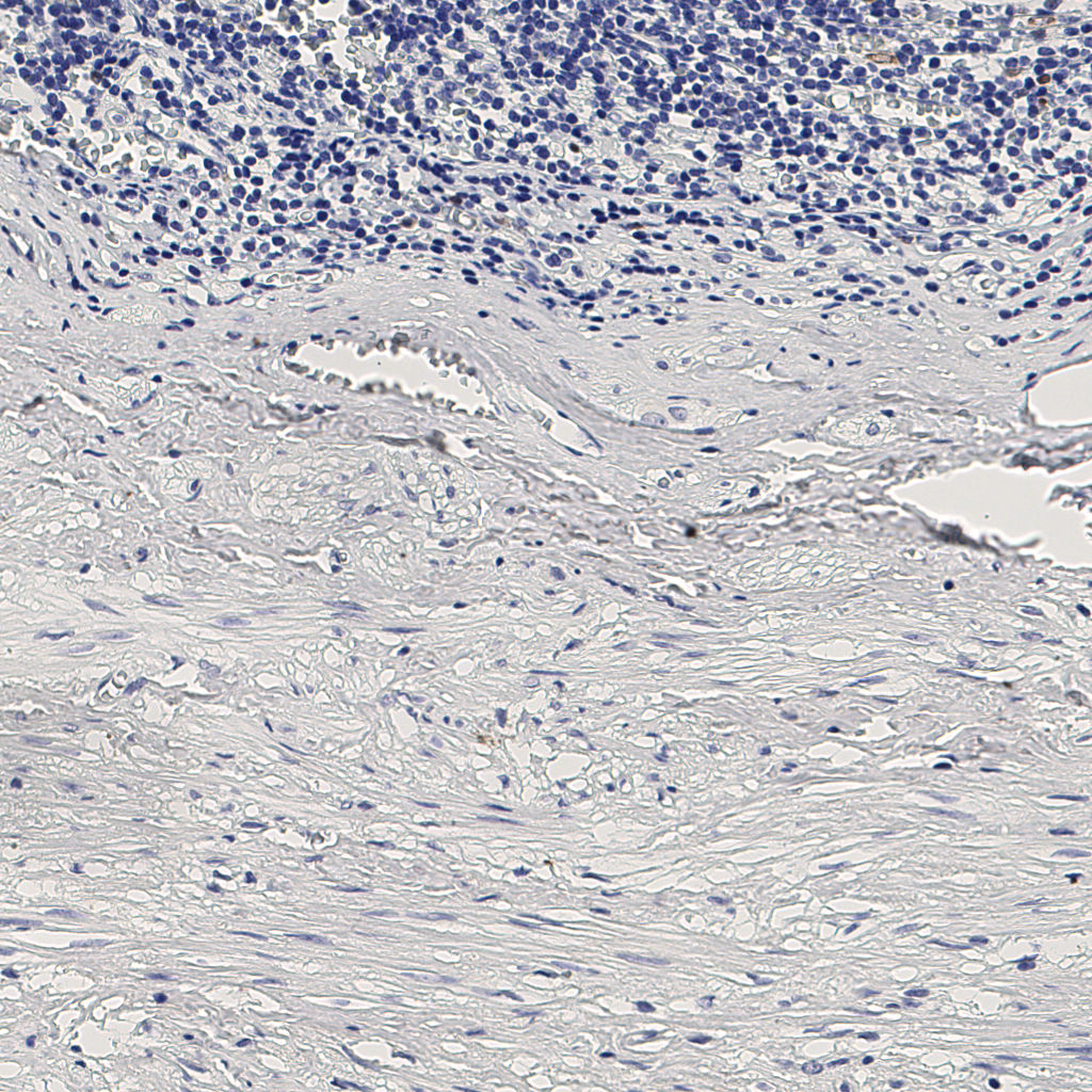 slice_9_27_x8064_y24192.png