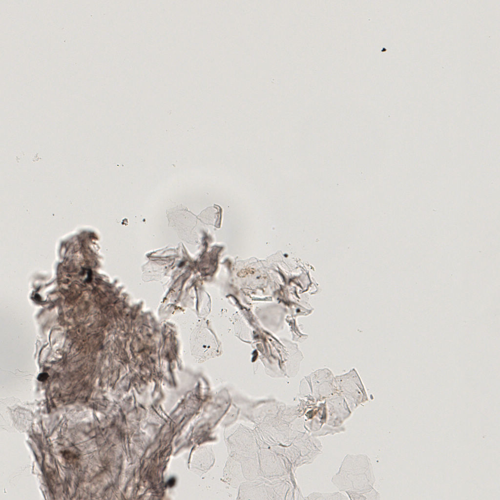 slice_17_11_x15232_y9856.png