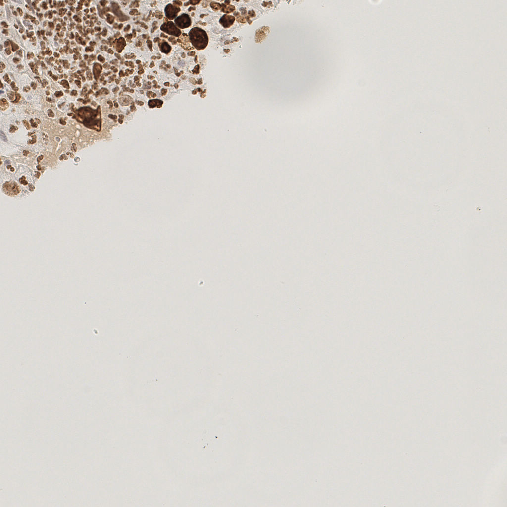 slice_19_19_x17024_y17024.png