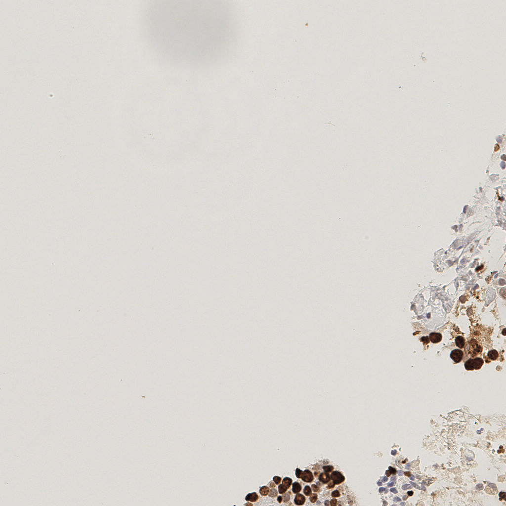 slice_37_7_x33152_y6272.png