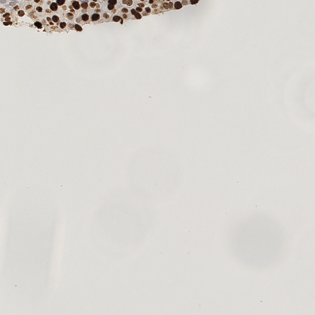 slice_42_10_x37632_y8960.png