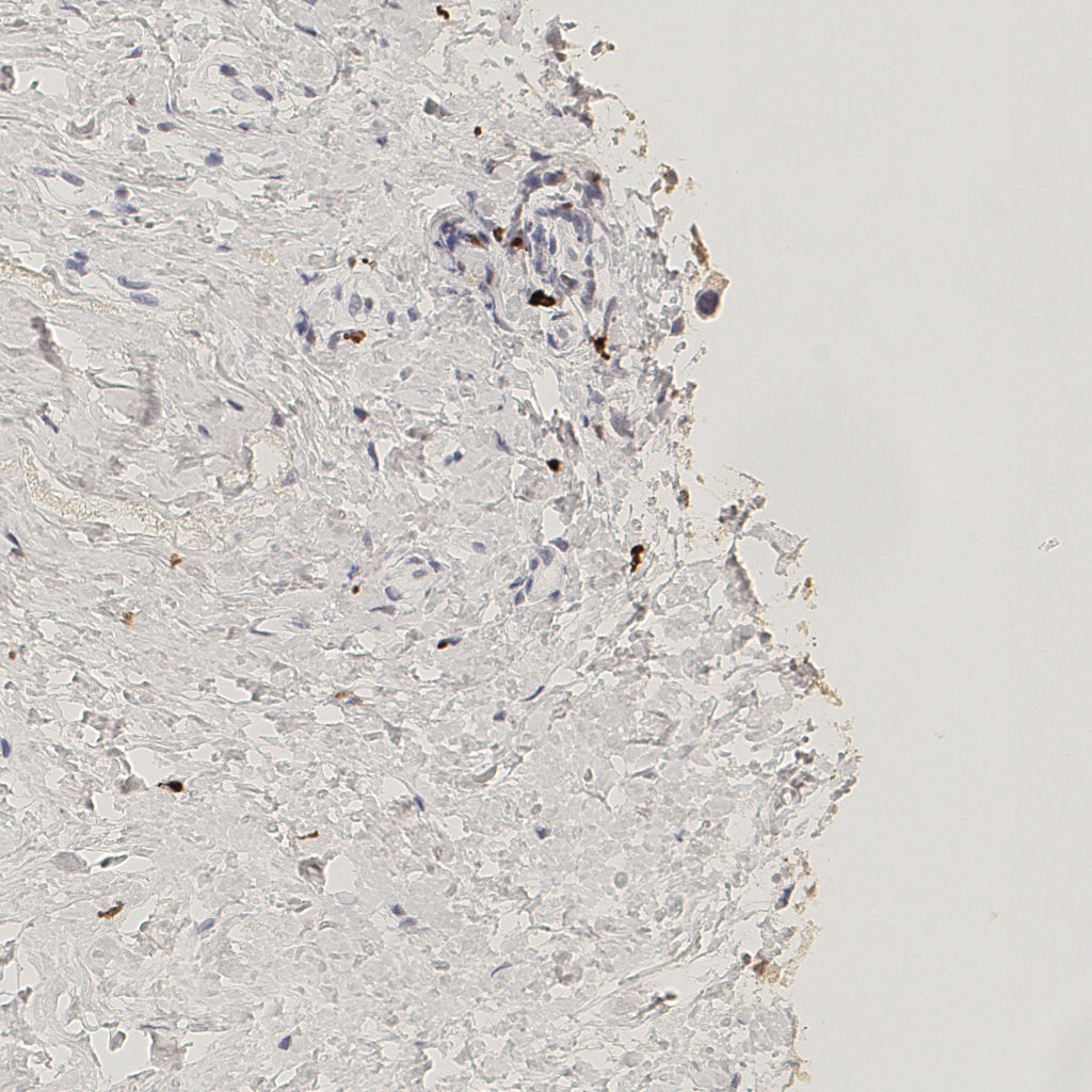 slice_45_20_x40320_y17920.png