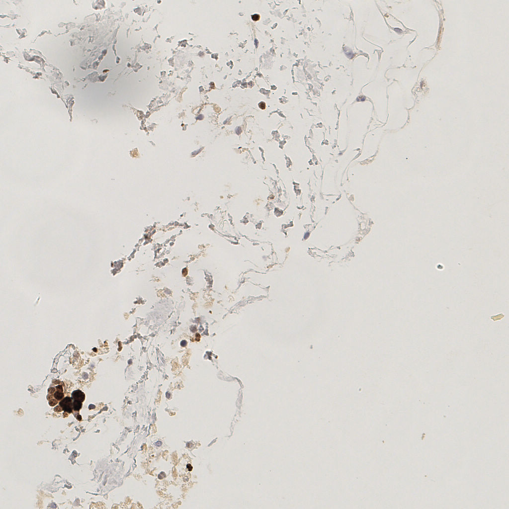 slice_55_13_x49280_y11648.png