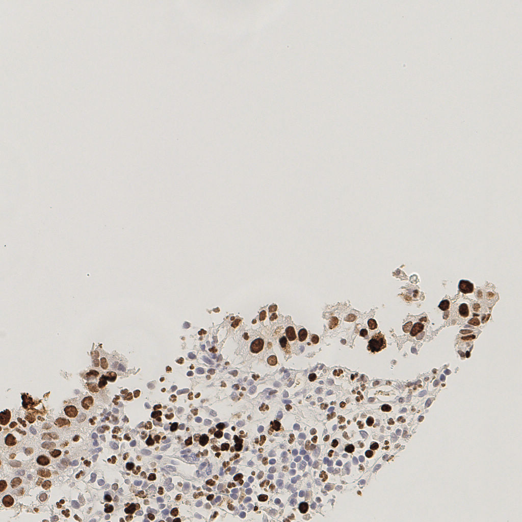 slice_5_26_x4480_y23296.png