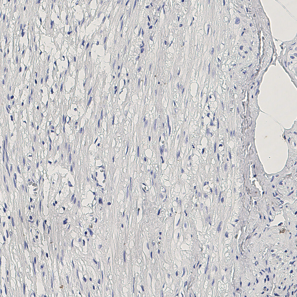 slice_5_24_x4480_y21504.png