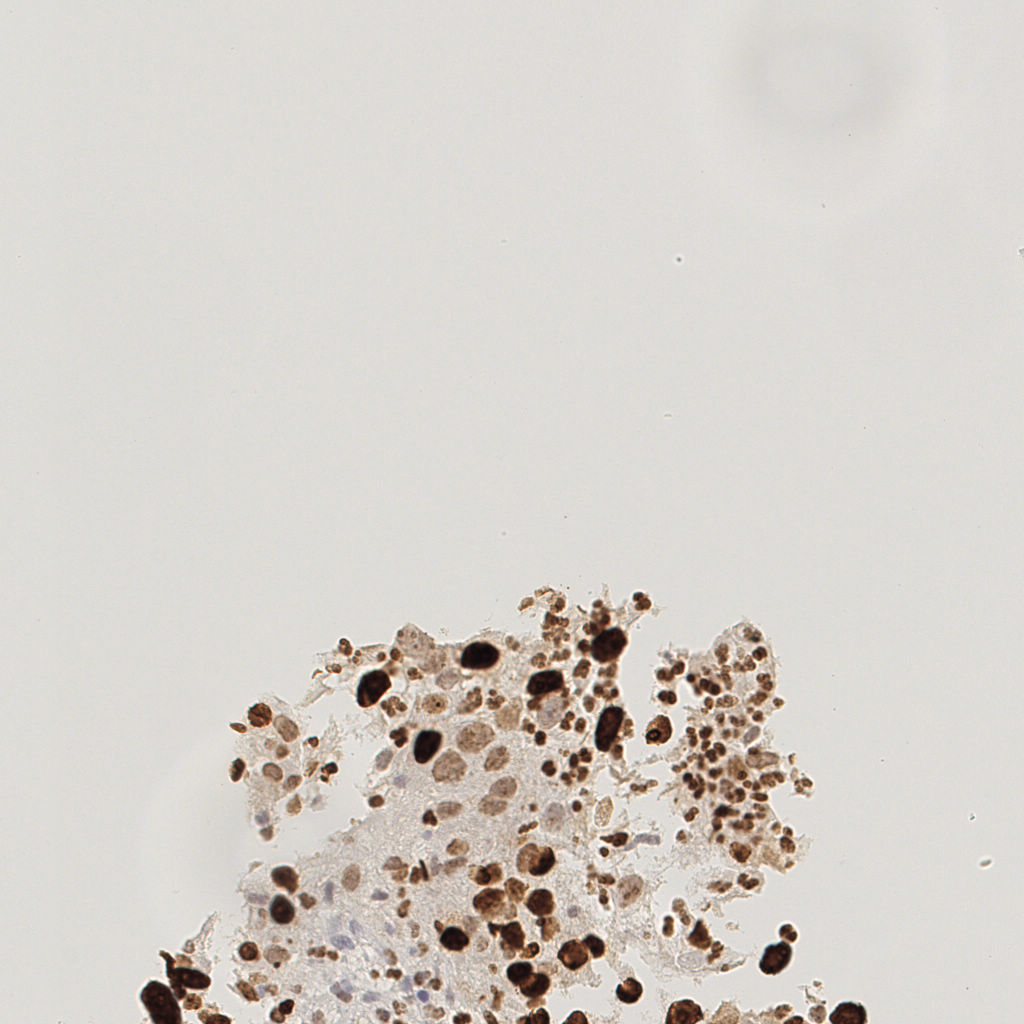 slice_18_15_x16128_y13440.png