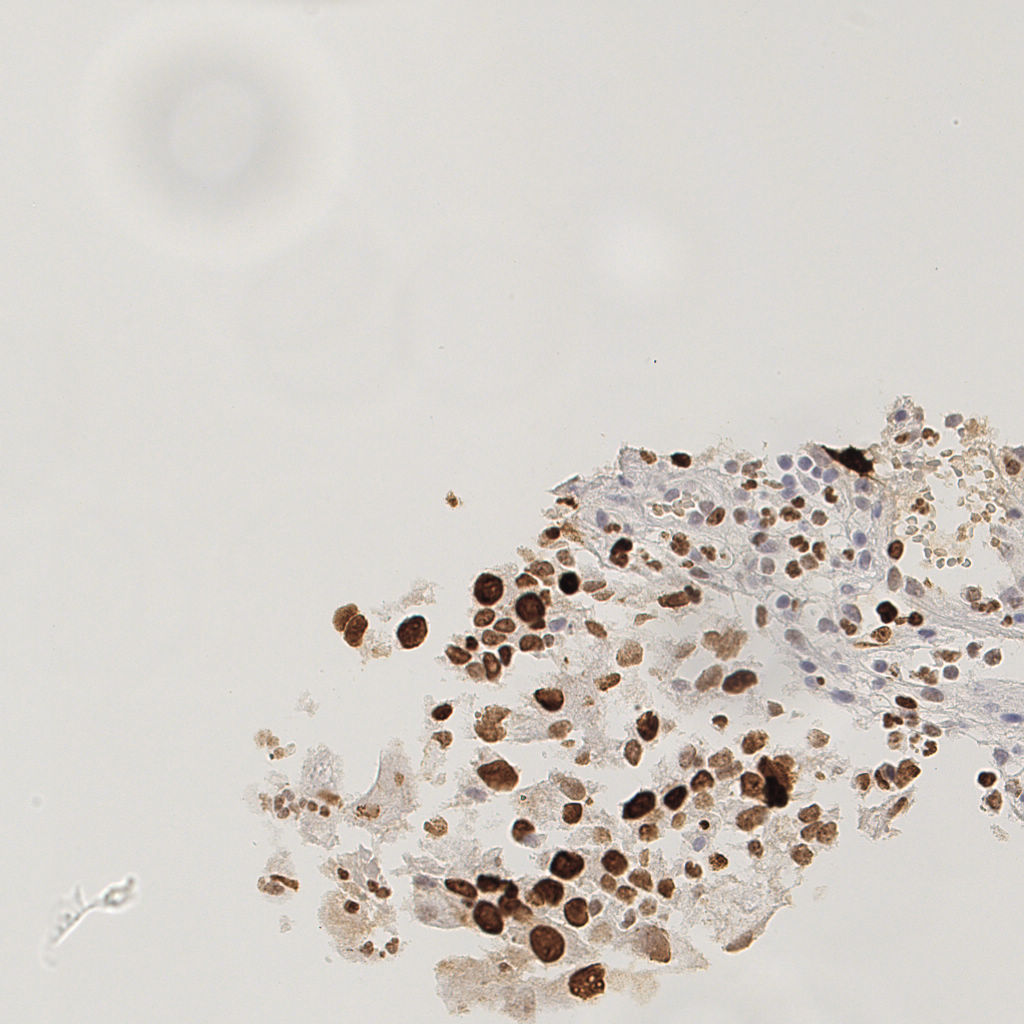 slice_20_20_x17920_y17920.png