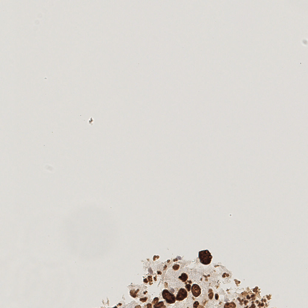 slice_22_19_x19712_y17024.png
