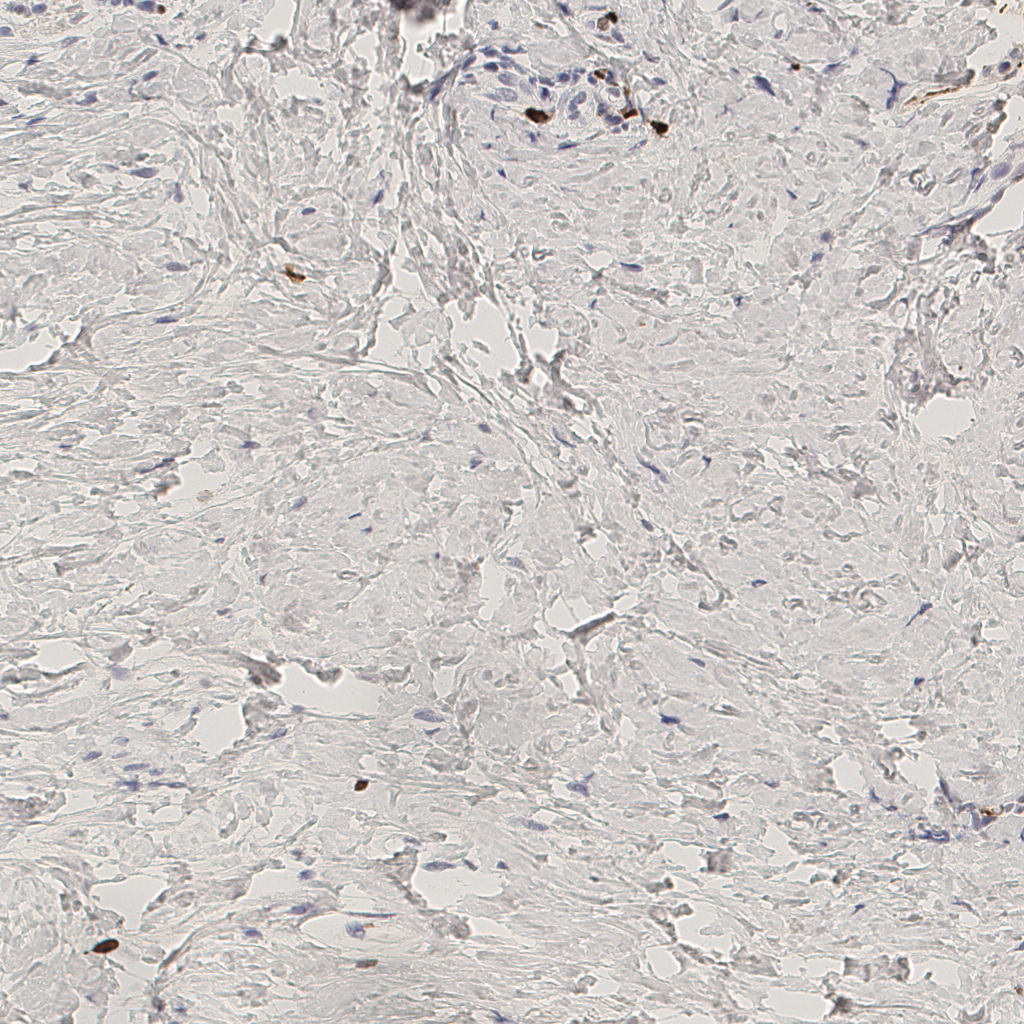 slice_44_19_x39424_y17024.png