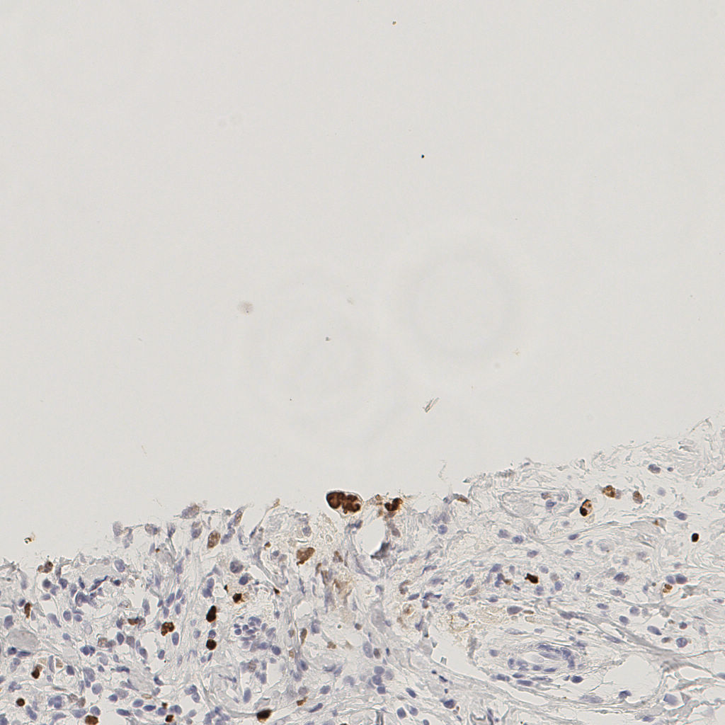 slice_47_12_x42112_y10752.png