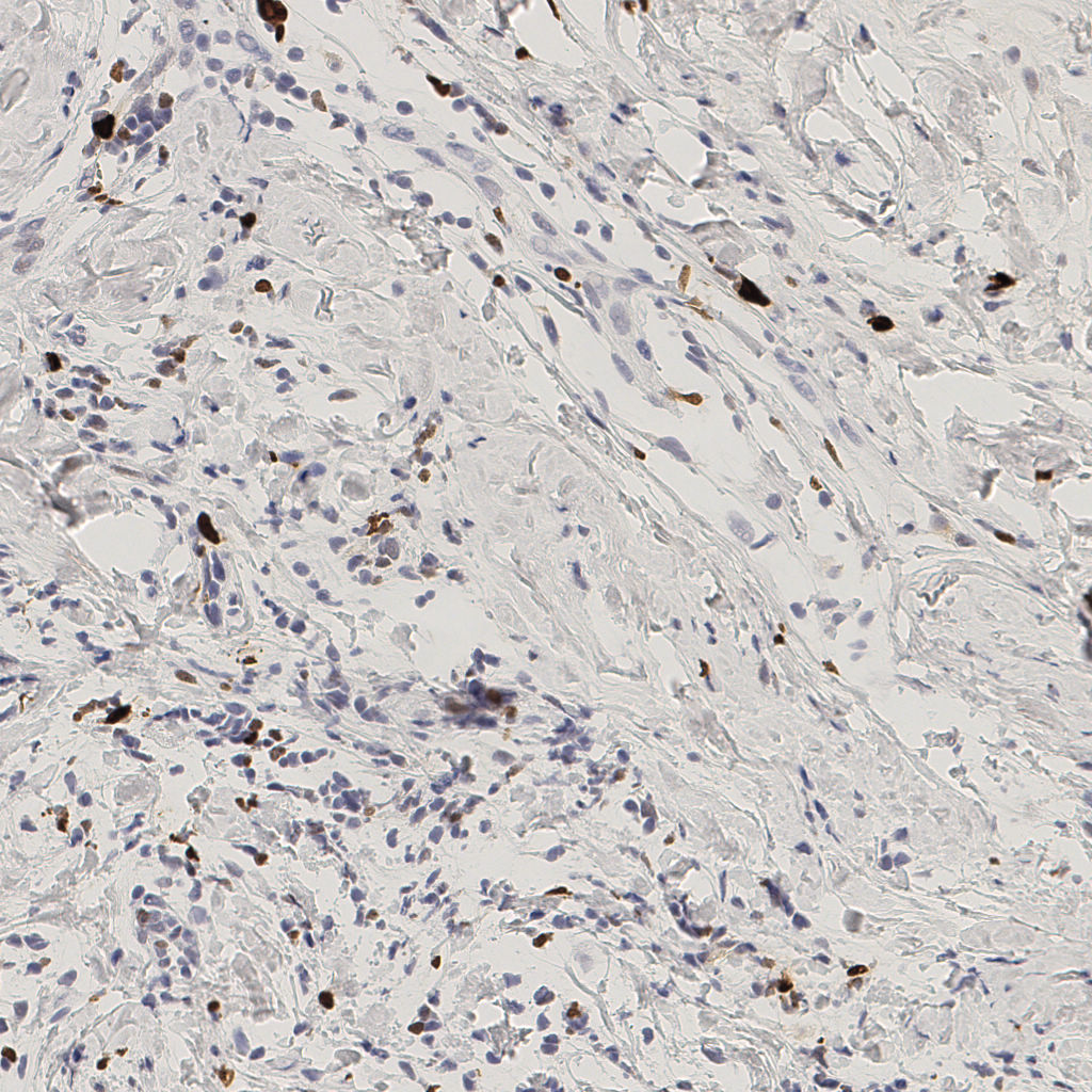 slice_51_15_x45696_y13440.png