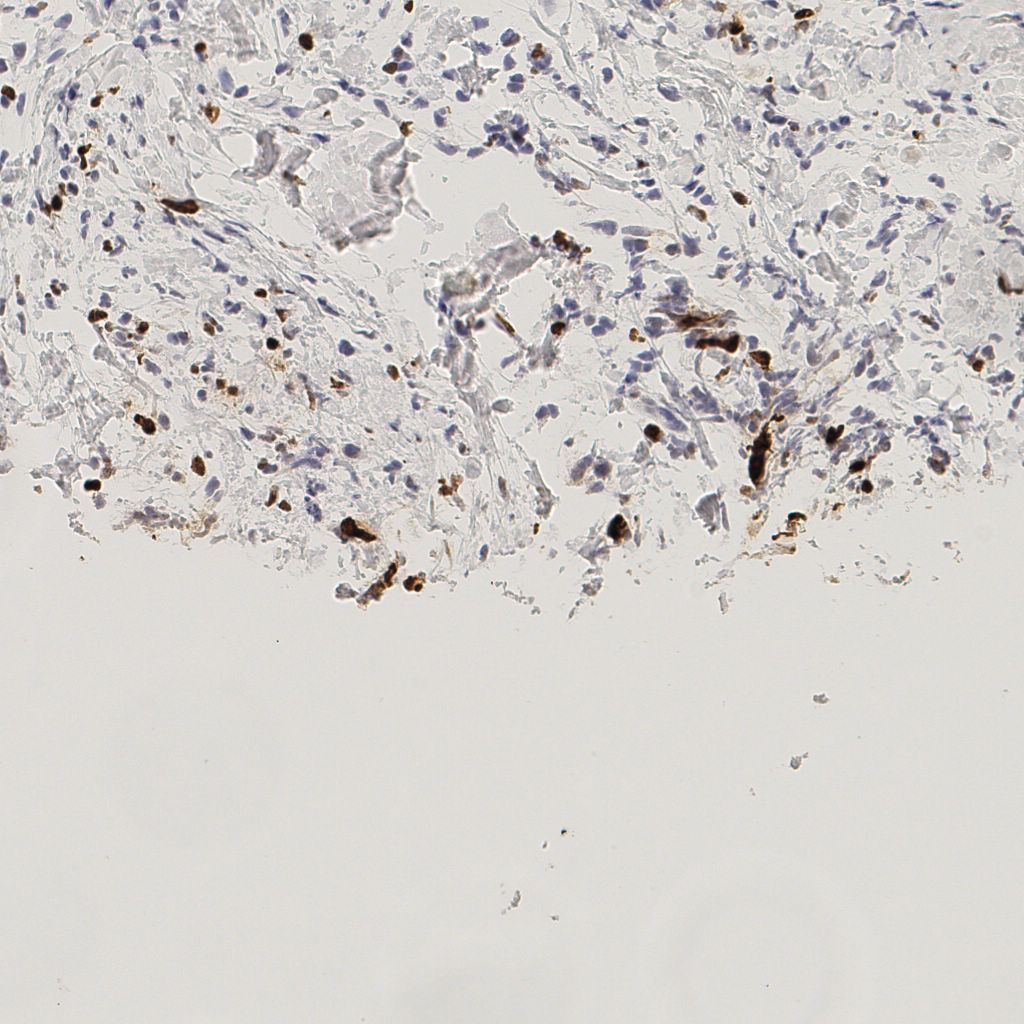 slice_51_16_x45696_y14336.png