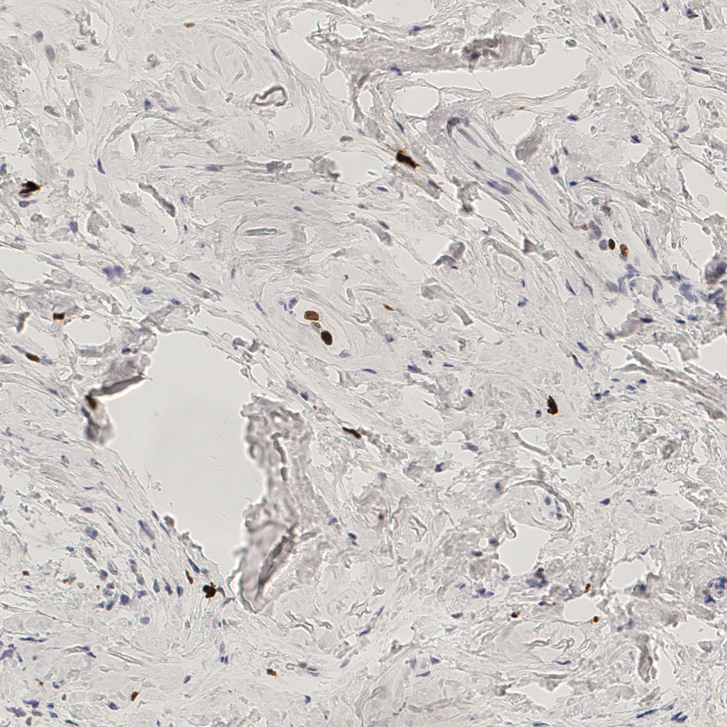 slice_52_15_x46592_y13440.png